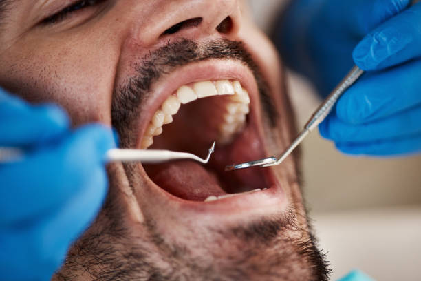 Best Emergency Treatment for Toothache in Atlantic, IA