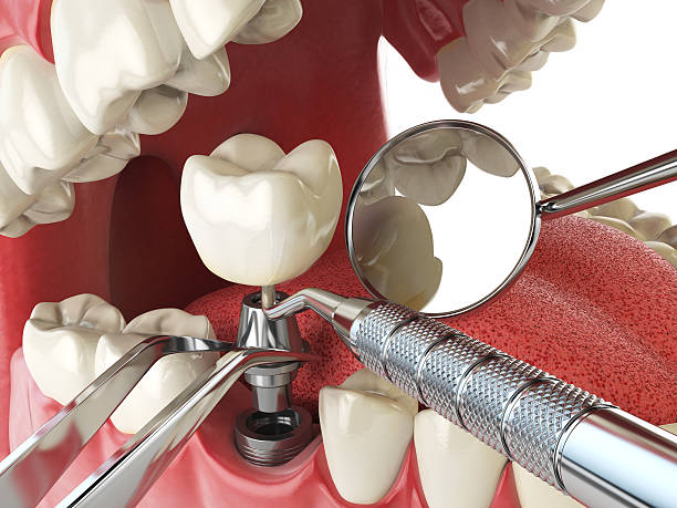 Best Emergency Wisdom Teeth Removal in Atlantic, IA